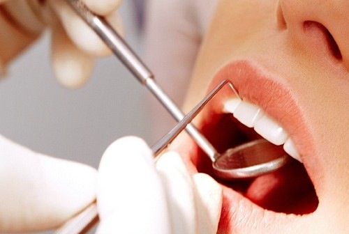 Falsi dentisti scoperti dalla finanza a Nizza Monferrato e Acqui Terme